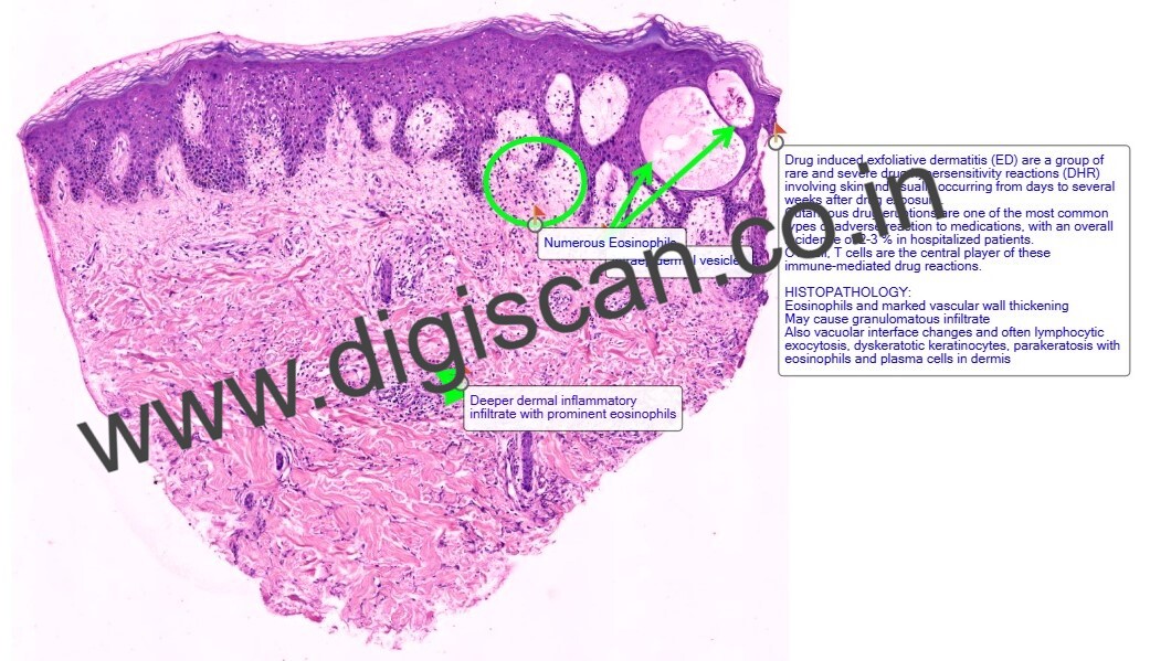 Dermatopathology Quiz Cases (Digital Slides for PG Exam & Self-Assessment)